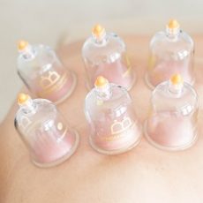 Cupping Therapy Benefits and Side Effects