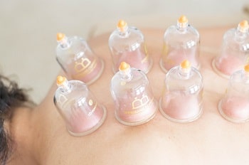 Cupping Therapy Benefits and Side Effects
