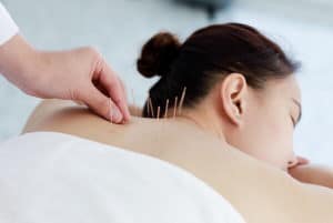 acupuncture near me