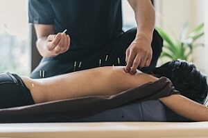 Acupuncture Near Me